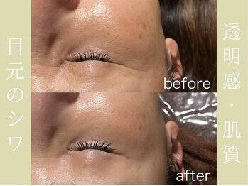 健志接骨院/πテラピー造顔メソッド