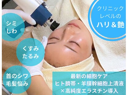 アンノン(Annon)の写真