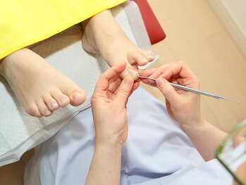 ドクターネイル爪革命 三郷店/【施術風景3】