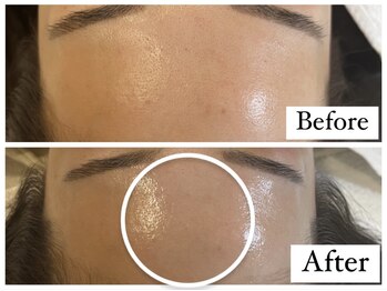 イオ(iO)/ー ワックス Before/After ー