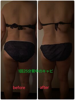 リンパセラピーファシル(Facile)/背中、腰回りたった1回の施術