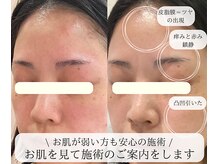ミュー 豊田店(mieux)の雰囲気（効果の出る施術★詳しくはブログへ）