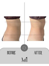 ミル 恵比寿店(Mill)/《痩身》