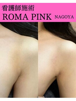 メディカルエース(MedicalAce)/ROMA