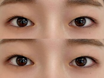 エムシー葵(MC葵)/似合わせまつげパーマ