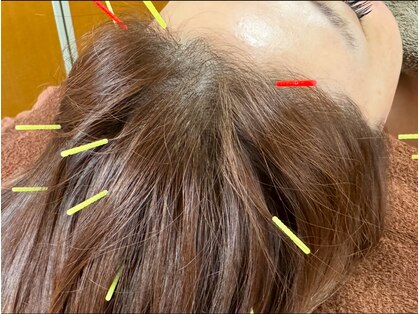 カラー(Calla)の写真