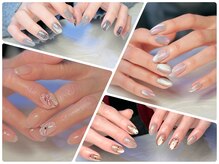 ツリートップス(Tree Tops)