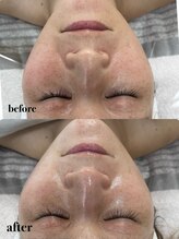 オル(Olu .)/クリスティーナ　アンストレス