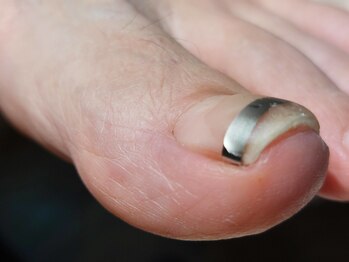 【PBスパンゲ その2】