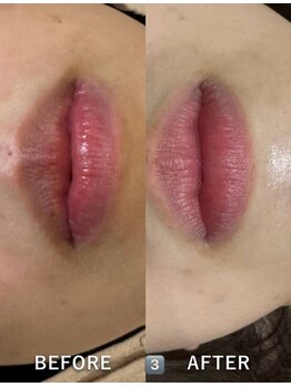 メディカルエース(MedicalAce)/ROMA