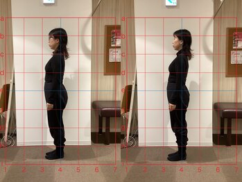 キラリ(KIRARI)/姿勢改善