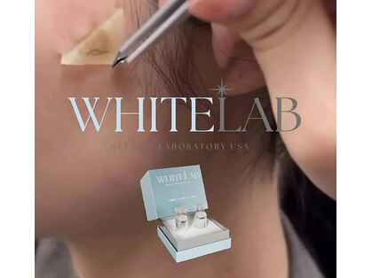 アザリーの写真