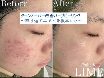 ライム 札幌(LIME)の写真