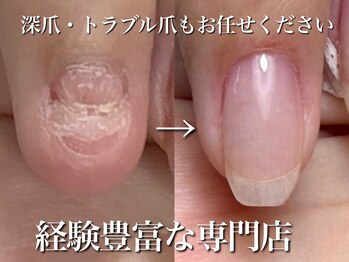リリーの写真/豊富な実績!特化型サロンだから初心者はもちろん、他で伸びなかった爪にも対応します。