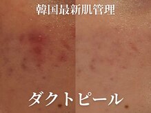 骨盤ダイエットサロン カンフリエ(camphrier)の雰囲気（夜21時まで営業★お仕事終わりの至福のひと時をお過ごしください）