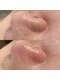 ビーマジック(Be Magic)の写真/気になる小鼻の黒ずみ・開きを徹底洗浄！つるんと滑らかな陶器肌へ導く毛穴特化メニューです☆