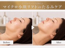 シルキーエービューティー(Silky A Beauty)