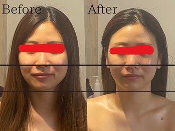 サロン ジジ(salon JiJi)/韓国小顔コルギ