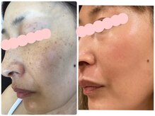 サロン シー(salon shhh...)/オンリーワンの肌質改善