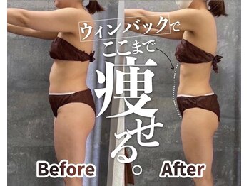 ウィンウィン 新山口店(Win Win)/WINBACK痩身40日通い放題