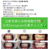 ホワイトニングサロン 名古屋 栄店