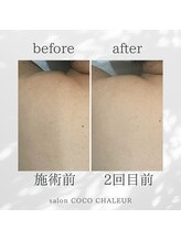 ココ シャルール(salon COCO CHALEUR)/Before　After