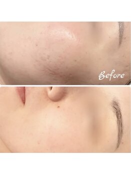 ラルミエール 緑店はなれ(la lumiere)/リゼネレート