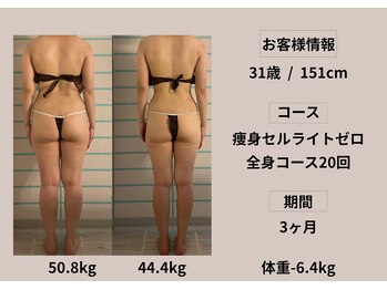 ハナメ(HANAME)/痩身引き締めコース