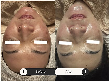 リマイン(Re mine)の写真