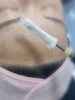 お肌をきれいにしたい