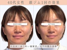 那賀洋子式 顔ジム 大分戸次店/40代女性顔ジム1回の効果
