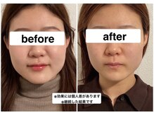 グリーン鍼灸整体院(green鍼灸整体院)の雰囲気(1回でも体感してもらえますが、継続する事でより効果がでます!)