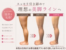 ヨサパーク ハーブ イムア(YOSA PARK imua)の雰囲気（即日効果実感！フォトギャラリーにもお客様の変化のせてます。）