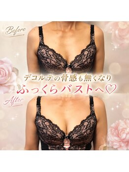 クオレア(cuorea)の写真/「もう若くないから」は思い込で勿体ない! 【施術歴16年・1万人以上が実感】 何歳からでも変わるバストへ