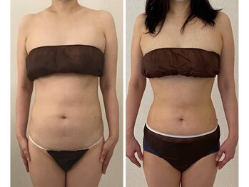 美人バスト 渋谷店/【痩身・ダイエット】渋谷/お腹