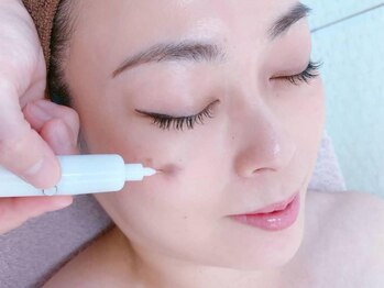 マハロ(mahalo)の写真/気になるシミ・しわのケアもmahaloにお任せください◎施術後のお肌の違いに感動…♪憧れのツヤ肌に！