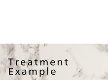 トランザット 代官山(TransATT)/