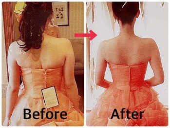 クイーンズ ピュア 新宿本店(Queen's Pure)/二の腕シェイプ