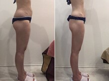 ビラ 銀座店(BILA)/キャビラジ