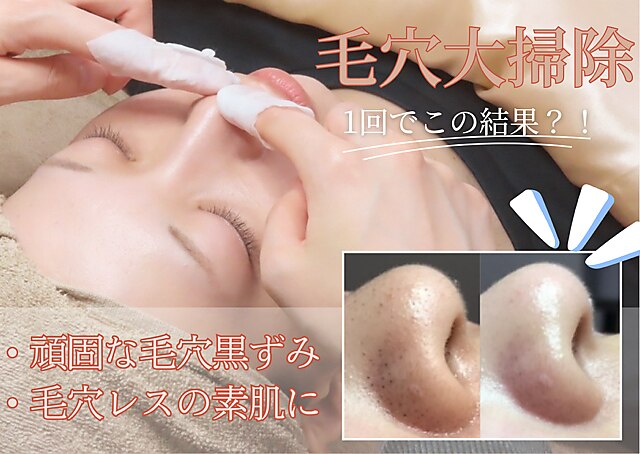 ルペルル(Le'perle。)｜ホットペッパービューティー