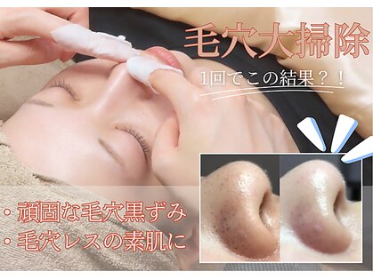 ルペルル(Le’perle。)の写真