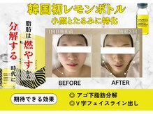 フレアージュ/レモンボトルフェイシャルBA