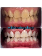 ホワイトニングショップ 葵区静岡駅店/ホワイトニング店ホワイトニング