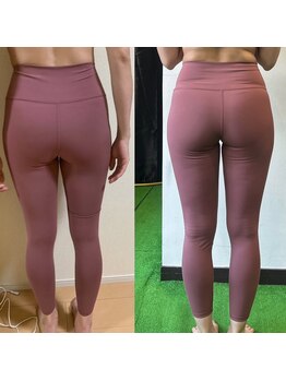 ビムキ(美MUKI)/30代女性/6ヶ月