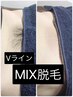 Vライン☆MIX脱毛【WAX脱毛＋SHR光脱毛】¥7700→¥4200