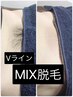 Vライン☆MIX脱毛【WAX脱毛＋SHR光脱毛】¥7700→¥6300