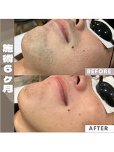 メンズキュー(Men's Cue)/