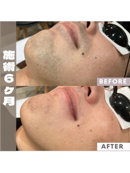 メンズキュー(Men's Cue)/