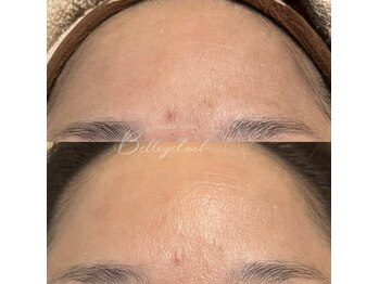 ベルアイラッシュ(Belleyelash)/【フェイシャルワックス】