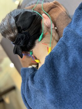 トイ鍼灸接骨院(TOY鍼灸接骨院)/●鍼灸